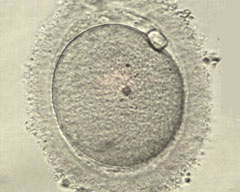Mature oocyte at the stage of metaphase II.